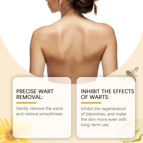 Wiyun Bee Venom – Crème Régénérante au Venin d'Abeille