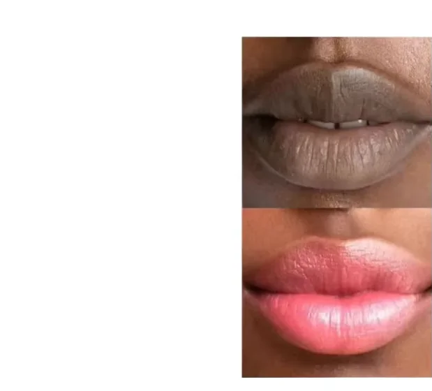 Des lèvres repulpées et ultra-brillantes ! ✨💋