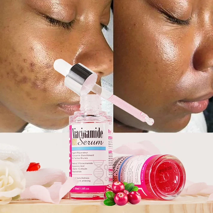 Sérum Alpha Arbutin & AHA – Éclat Intense & Anti-Taches (Visage & Corps)