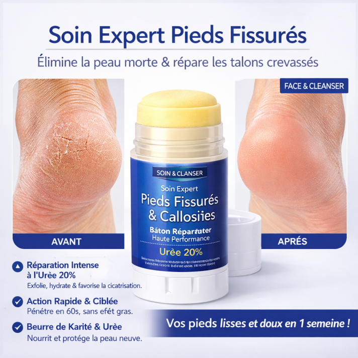 Bâton réparateur pour pieds fissurés à l’urée 20% et beurre de karité, format stick sans film gras
